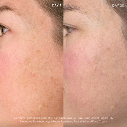 Doctor Rogers Day Preventive Treatment  | Best vitamin c serum before and after 30 day results displaying woman with educed fine lines and dark spots